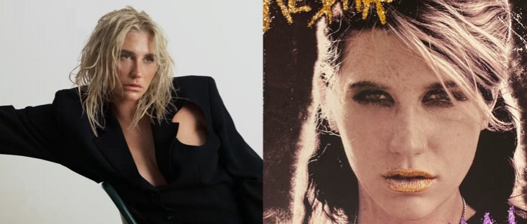 Kesha diz estar escrevendo ‘irmão’ do aclamado “Animal”